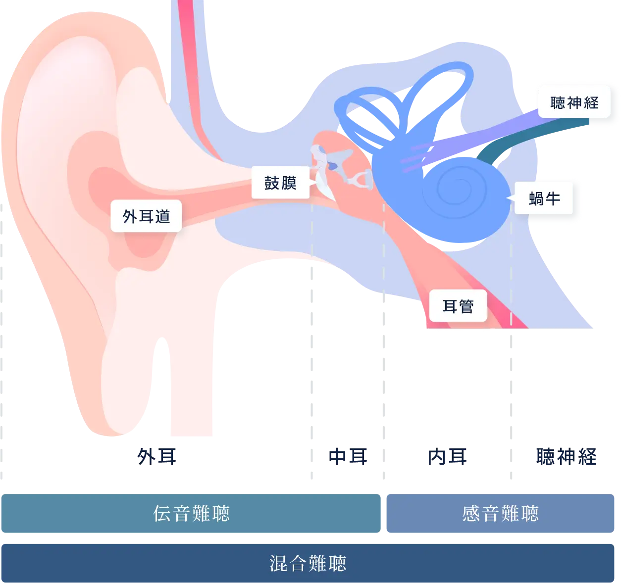 耳の形状の図形